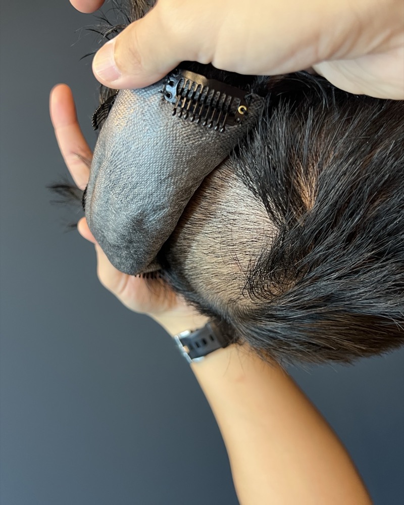A custom Crowning hair system being fitted